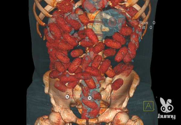 118dd1910fe2bf63858bbd861e9bef1f