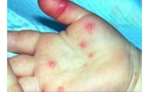 3ee12a13268fcdff98d9cae8b0fd96a7_L