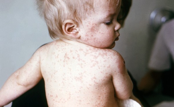 159145-03042015-1428022436-1490584561-ulaanburhan