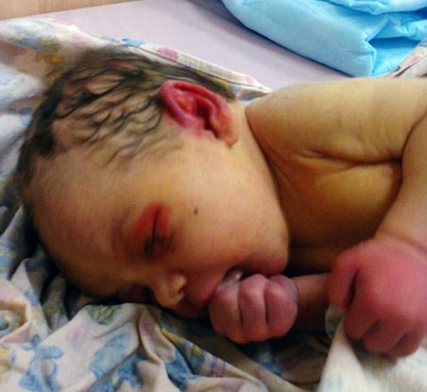 Pic shows: The baby rescued in a forest. Russian police are investigating after a newborn baby girl was found covered in ants that had started to try and eat her. The badly bitten child had been spotted by somebody walking in woodland on the outskirts of the central Russian city of Chelyabinsk. A police spokesman said: "The person that found the baby girl heard her crying, and on investigating discovered the child lying on a pile of leaves and covered in ants. It was clear that the child had been abandoned and there was no one else in sight, so they picked her up and called for an ambulance." The police said that if the villager had not noticed the baby girl, she was unlikely to have survived much longer. The child still had the umbilical cord attached when she was found by the man, who was on his way to work and taking a shortcut. They said that the child was estimated to be about three days old and after treatment for the bites, was now stable and expected to make a full recovery. She is currently being treated at a hospital in Chelyabinsk and police are making efforts to track down her parents, and investigating the circumstances under which she was abandoned. (ends)