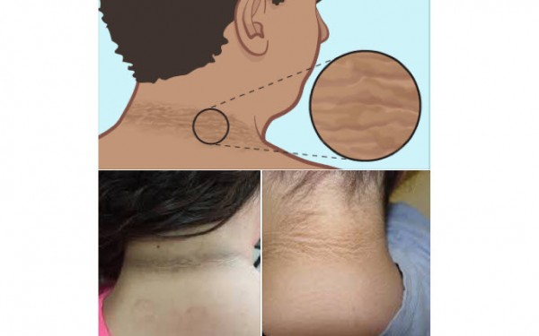 1q1gk0hd29nq51nhs9uhk2com3