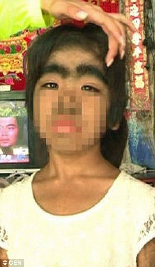 2AB2D5E300000578-3168486-Xiaoling_is_covered_in_dark_black_hair_from_head_to_toe_and_real-a-39_1437411408890