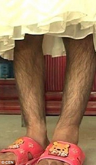 2AB2D5F300000578-3168486-She_cannot_usually_swim_or_wear_shorts_or_dresses_as_she_often_g-a-40_1437411412171