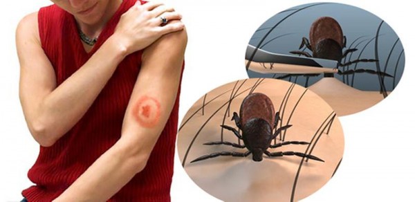 44af7091-fe08-4da0-8d73-1eb800ba5d81