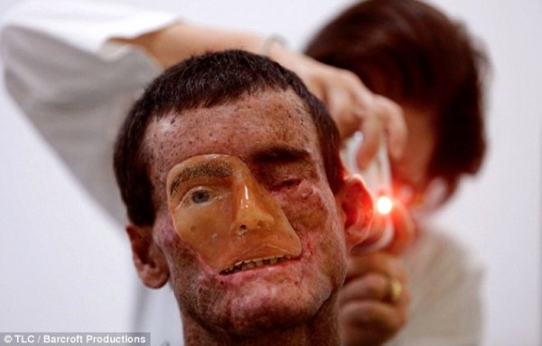 2B74DDF000000578-3202069-Genetic_condition_Djalma_Jardin_has_just_one_that_he_can_t_close-a-2_1439910116186