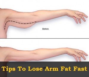 Arm Fat
