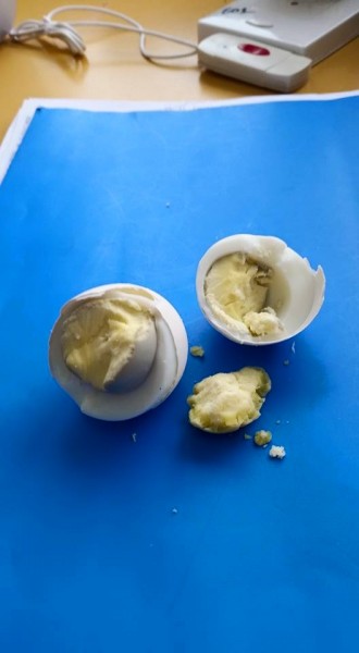 d72f5756e8f18104dc364f10e5ece09b