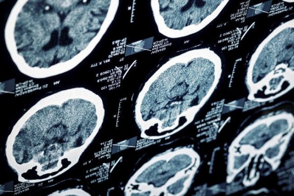 5pdp0u1ptfuqj8muh8rubi6f1k