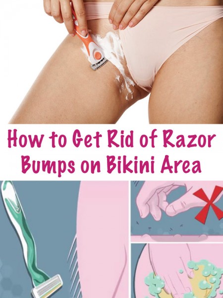 How-to-Get-Rid-of-Razor-Bumps-on-Bikini-Area