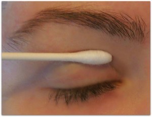 apply-qtip-drooping-eyelid1-300x232-300x232