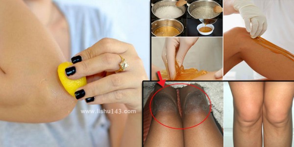 How-To-Get-Rid-Of-Black-Kness-and-Elbows-in-Just-7-Days