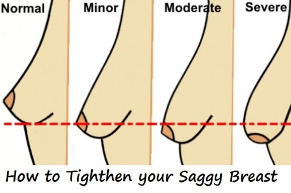 be0f542f10c5590a2cc45978047ce875