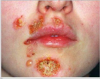 11026212_1196778253671770_2767001093331889128_n