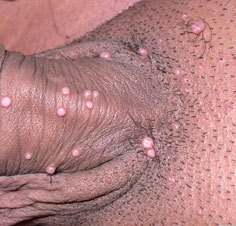 11178258_1093070900709173_7373201341547721883_n