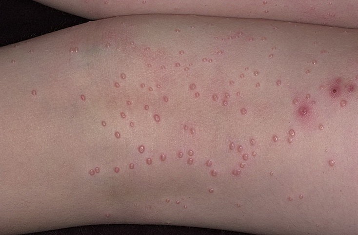 11204890_1093070960709167_6584803194496279637_n