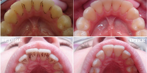 12687935_830656353729007_4384046531660654108_n