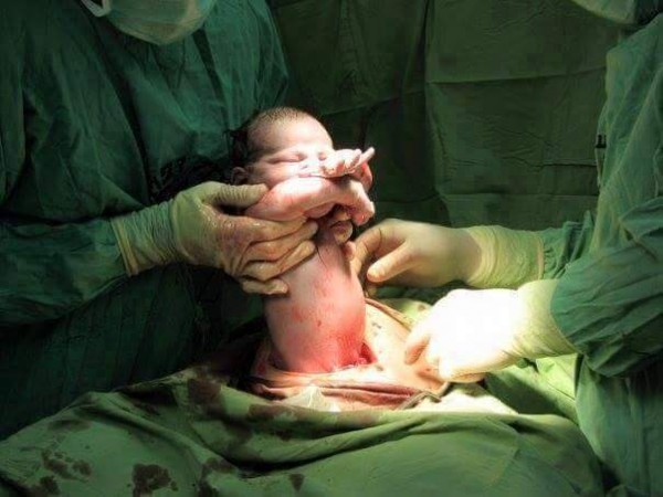 12795457_896961863758560_3058815486146316663_n