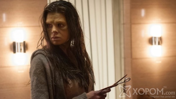 XopoM.com-Итгэхийн-аргагүй-аймшигтай-ховор-өвчнүүд-06