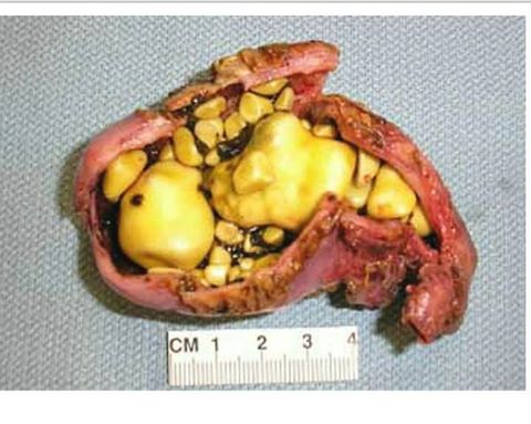 13076546_1559246441041788_1273225750325304590_n