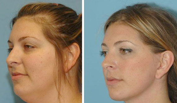 1201603071457326062 (2)