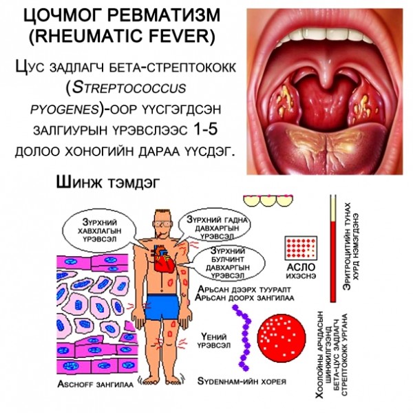 1464146262574519564defb