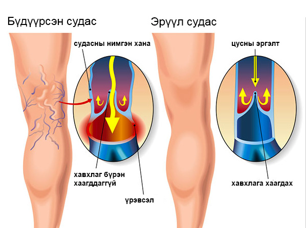 6h4ferfcj14h6qealvmbepe4uq