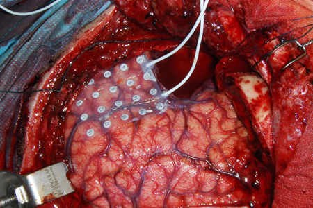 8dhm8v5pp9coa4l1ormb12n4u_b